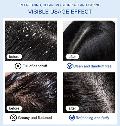 Selenium dioxide shampoo — — Anti-dandruff, anti-itching, oil control