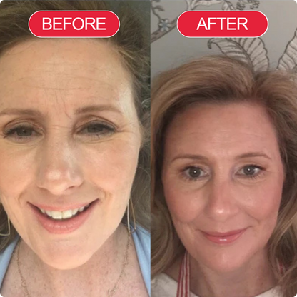 Koriderm Time ReverseCream (All-In-One)